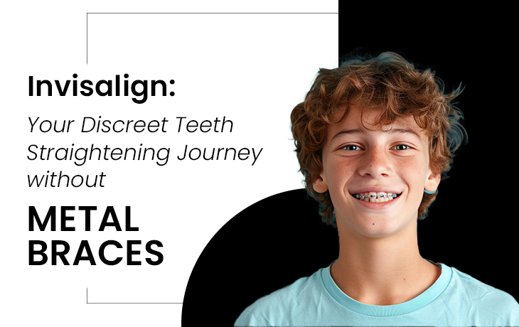 Invisalign: Your Discreet Teeth Straightening Journey without Metal Braces