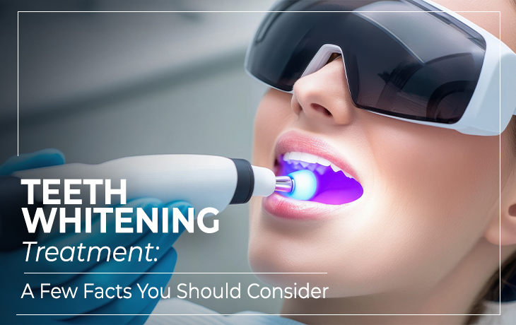 Teeth Whitening Treatment: A Few Facts You Should Consider